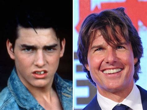 Total 36+ imagen tom cruise before and after teeth - fr.thptnganamst.edu.vn