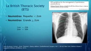 Porcentaje de neumotorax | PPT