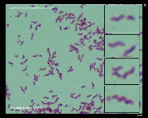 Campylobacter Gram Stain Morphology | SexiezPicz Web Porn