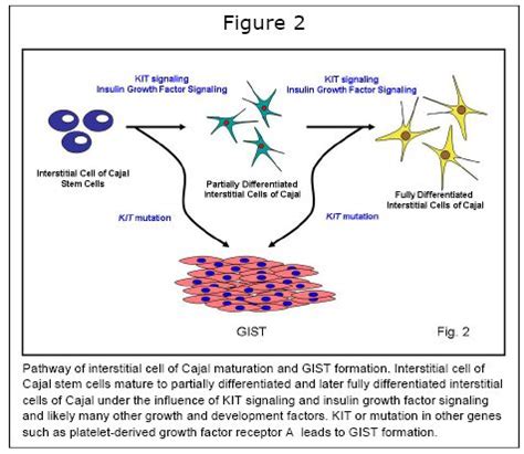 Interstitial cells of cajal