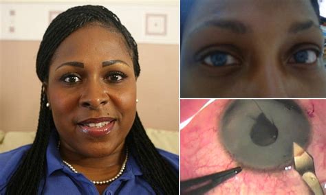 'I wanted to change my eye colour with surgery - but ended up blind' | Eye color change, Eye ...