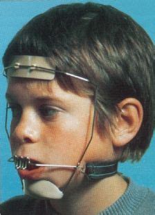 Original orthodontic headgear | Orthodontics, Vintage medical, Dental humor