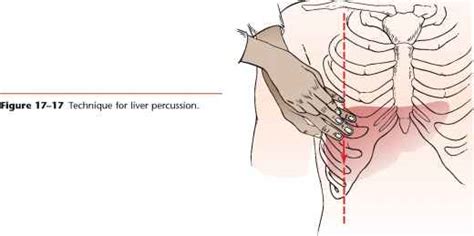 Percuss the Liver - Physical Diagnosis - Mitch Medical Healthcare