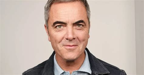 Cold Feet star James Nesbitt having SIXTH £20,000 hair transplant ...