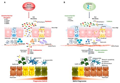 Nutrients | Free Full-Text | The Role of Probiotics in Nonalcoholic Fatty Liver Disease: A New ...