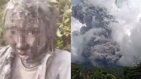 Kondisi Zhafirah Korban Erupsi Gunung Marapi yang Viral, Sudah Bersama ...