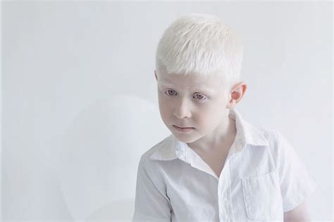 15+ Albino People Who’ll Mesmerize You With Their Otherworldly Beauty - An Eclectic Site for ...