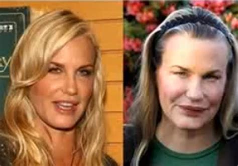 17 Celebrity Before-And-After Plastic Surgery Disasters - Business Insider