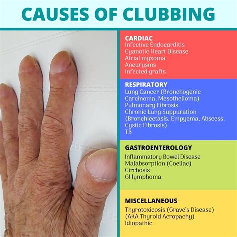 Causes of Clubbing | Pulmonary fibrosis, Graves disease, Inflammatory bowel disease