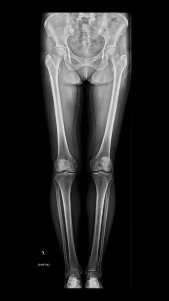 Anatomy Leg Pictures Stock Photos, Pictures & Royalty-Free Images - iStock