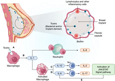 Cancers | Free Full-Text | Anaplastic Large Cell Lymphoma: Molecular Pathogenesis and Treatment