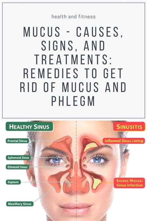 Mucus - Causes, Signs, And Treatments: Remedies To Get Rid Of Mucus And Phlegm | Getting rid of ...