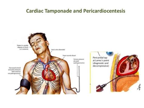 Pericardium Anatomy