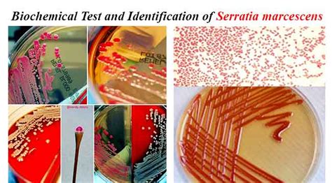 Serratia Marcescens Colony Morphology