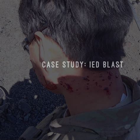 Case Study: IED Blast | Ready Warrior LLC