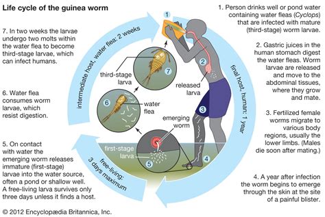 Guinea worm disease | Definition, Infection, Treatment, & Eradication ...