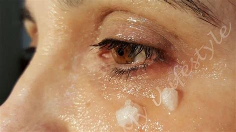 She Started Applying Coconut Oil Around Her Eyes 5 Minutes Later Unbelievable | My Healthy Life ...