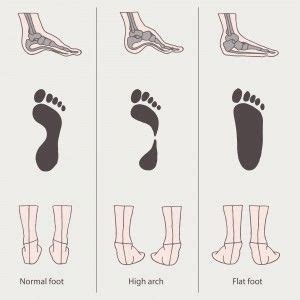 Your Feet Are the Windows To Your Crossfit Future | Flat feet exercises, Foot exercises, Flat feet