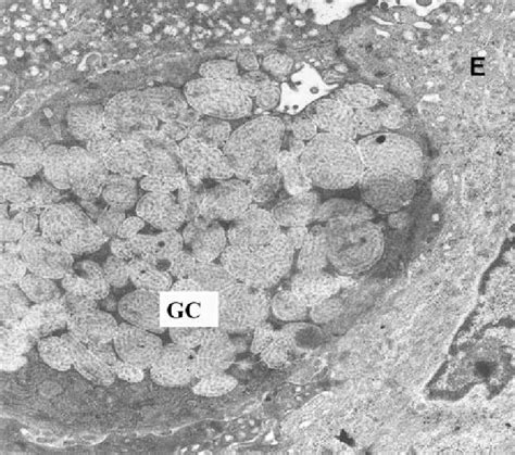 Transmission electron microscopy of a control group specimen. Normal... | Download Scientific ...