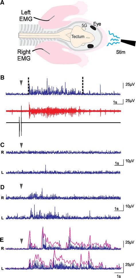 EMG experiments. A, Schematic representation of the preparations used... | Download Scientific ...