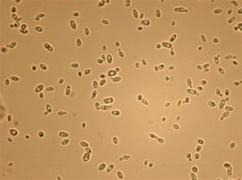 Microscopic Morphologic Features of Yeast | Medical Laboratories