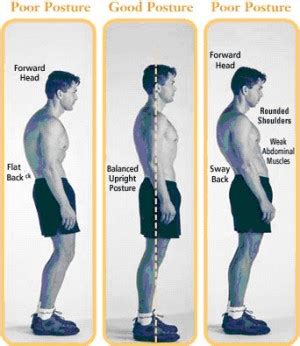 Forward Head Posture - Treat Yourself Naturally