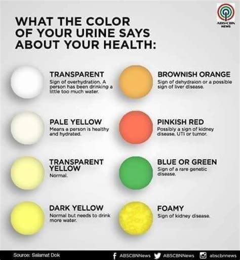 What The Color Of Your Urine Says About Your Health (Infographic) | Kinnaka's Blog