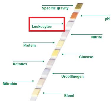 Leukocyte esterase (LE): Test, Trace and Treatment – Drug Details