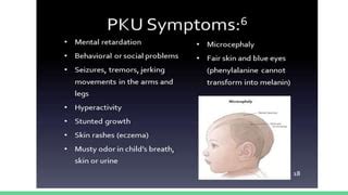 Phenylketonuria Symptoms