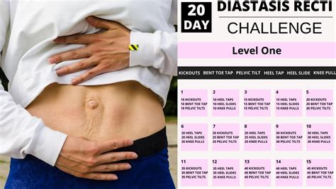 Diastasis Recti Training Program | EOUA Blog