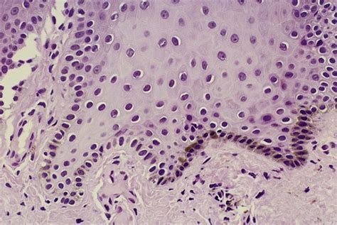 5: Pigmented Lesions | Pocket Dentistry