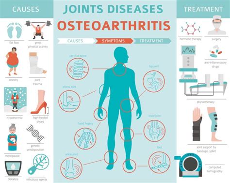 What is Osteoarthritis? Causes, Symptoms & Risk Factors of Osteoarthritis