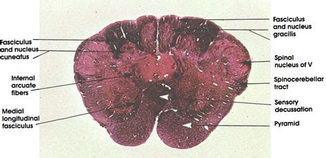 Plate 17.328 Medulla Oblongata