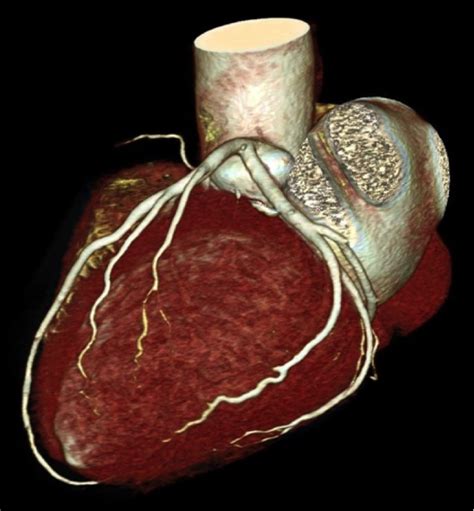 San Radiology & Nuclear Medicine - Cardiac CT