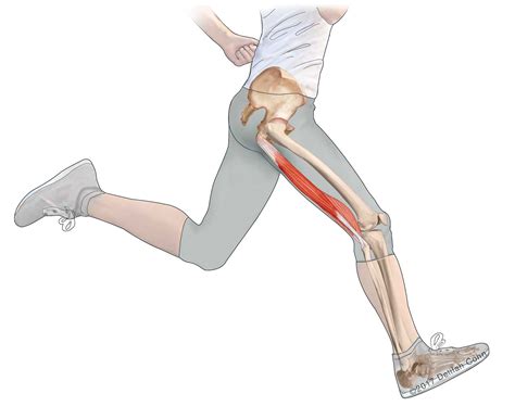 Hamstring Injuries | Biceps Femoris | Semitendinosus | Semimembranosus