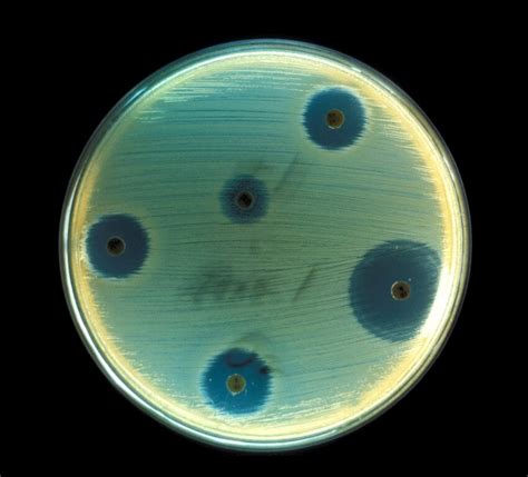 Free picture: toxin, staphylococcus aureus, illness, staphylococcal ...