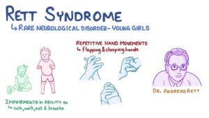 RETT SYNDROME