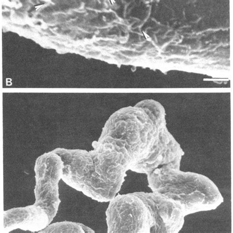 Scanning electron micrographs of isolated muscle fibers. (A) Relaxed... | Download Scientific ...