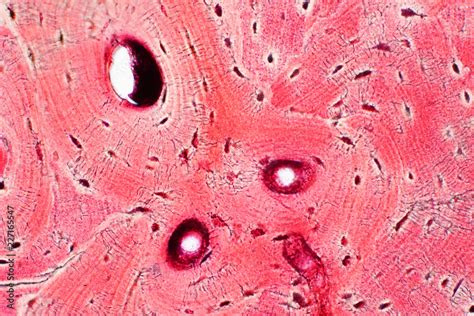 Histology of human compact bone tissue under microscope view for ...