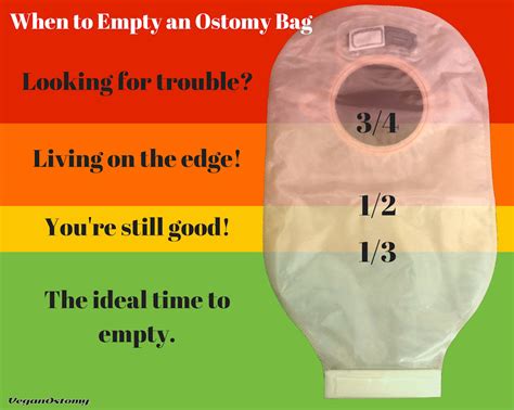 8 Ostomy Leak Prevention Tips | Ostomy Belts | Stealth Belt