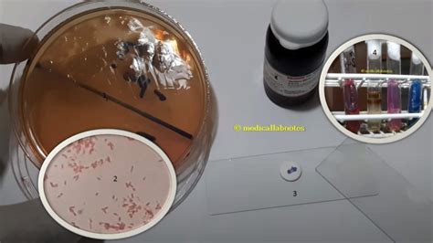 Pseudomonas aeruginosa growth on thioglycollate broth showing pellicle formation of growth on ...