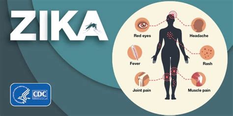 Symptoms | Zika virus | CDC