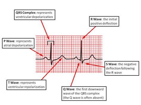 Waves and complexes