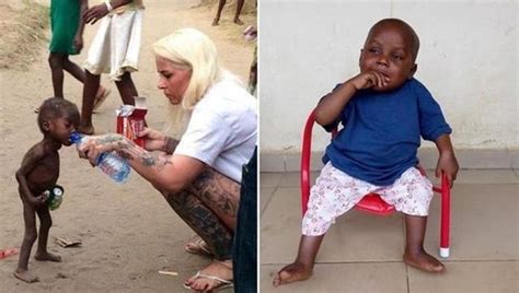 Starving toddler from viral photo thriving after rescue