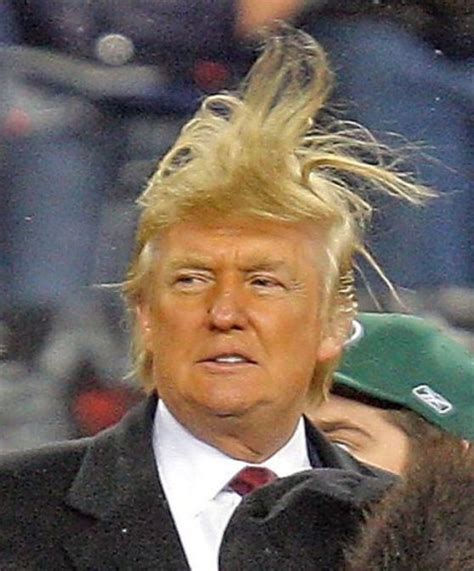 Donald Trump has bad hair.