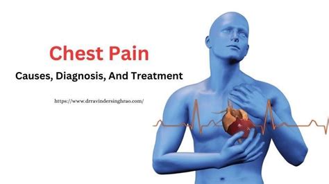 Chest Pain – Causes, Diagnosis, And Treatment by Dr Ravinder Singh Rao - Issuu