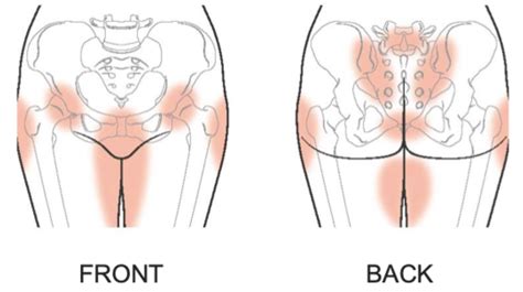 Pregnancy Pelvic Girdle Pain | Thrive Physio Plus