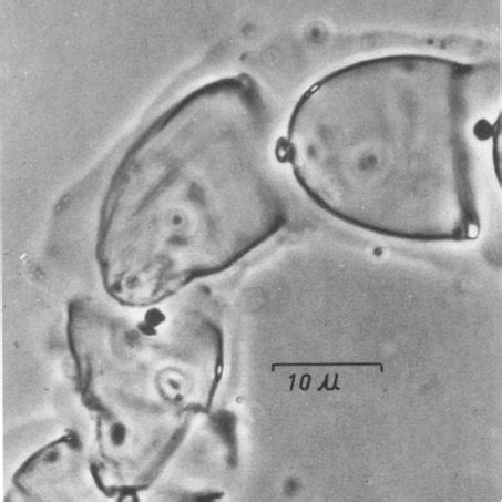 Gymnodinium splendens. (a) Normal cell, (b) abnormal cells | Download ...