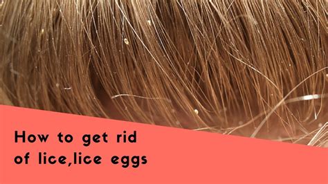 Home Remedy Kill Lice Eggs | Review Home Co