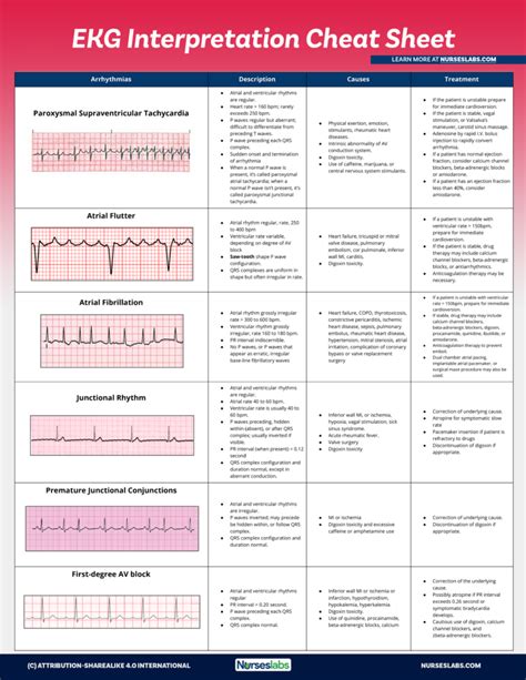 Ekg Interpretation Cheat Sheet Printable - Printable Word Searches